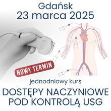 DOSTĘPY NACZYNIOWE POD KONTROLĄ USG